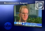 Wade Cook, eye reconstruction