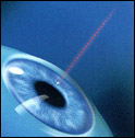 Intralse Surgery Photo 1 - Tennessee